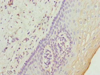 UGT2B10 Antibody