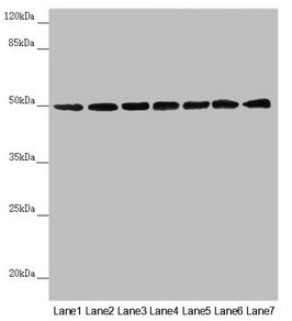UQCRC1 Antibody