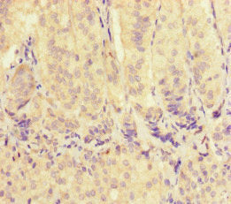 VDAC2 Antibody