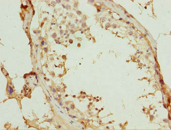 WDR47 Antibody