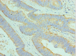 DCAF7 Antibody