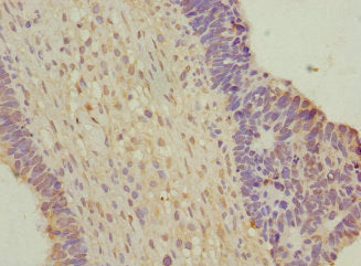 WNT7B Antibody