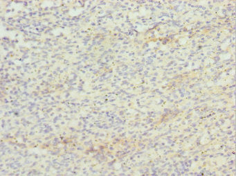 ZBTB48 Antibody