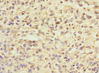 ZIC3 Antibody