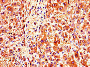 ZMPSTE24 Antibody
