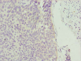 ZSCAN26 Antibody