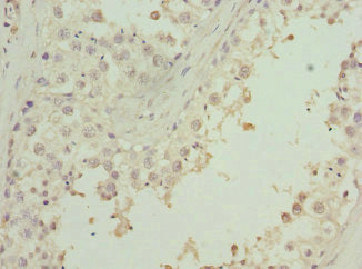 ZNF350 Antibody