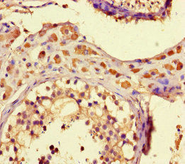 ZNF408 Antibody