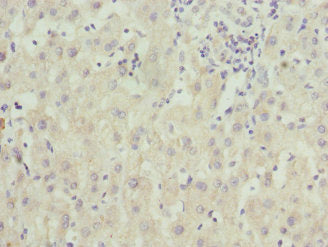 ZNF544 Antibody