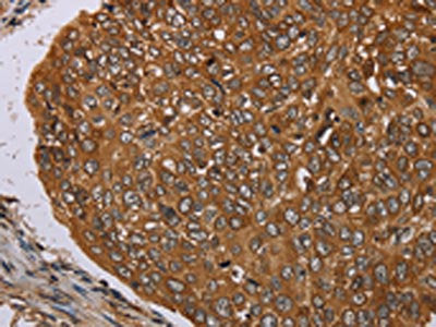 PIM3 Antibody