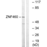 ZNF460 Antibody