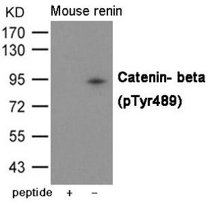 Phospho-CTNNB1 (Tyr489) Antibody