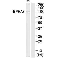EPHA3 (Ab-602) Antibody