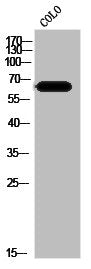 SLC39A4 Antibody