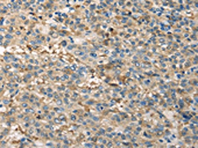 TPSB2 Antibody