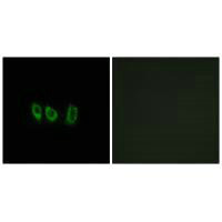 CSTL1 Antibody