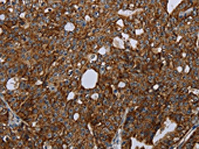 HMGCR Antibody