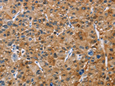 NCR3 Antibody