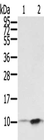 S100P Antibody