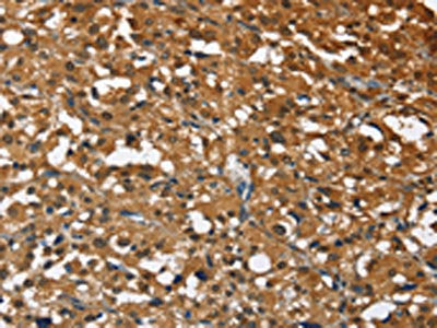 STK17B Antibody