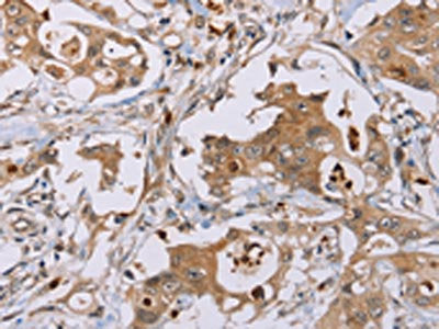 OTC Antibody