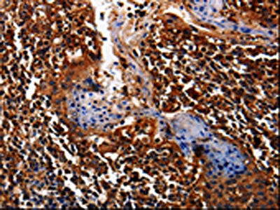 ALPL Antibody