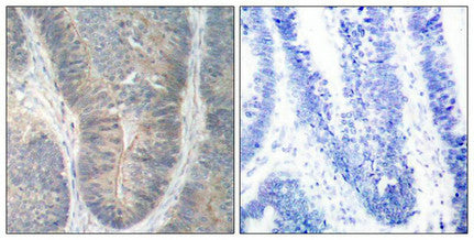 Phospho-EIF2AK2 (Thr451) Antibody