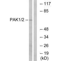 PAK1 (Ab-199) Antibody