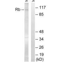 RB1 (Ab-608) Antibody
