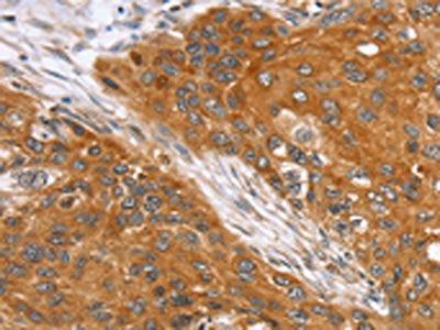 SLC25A13 Antibody
