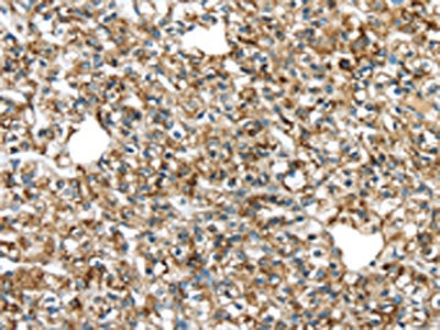 TGM4 Antibody