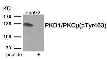 Phospho-PRKD1 (Tyr463) Antibody