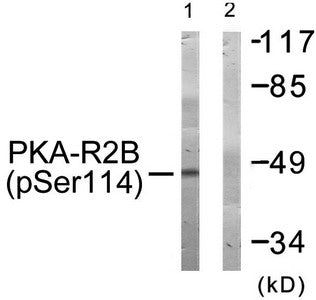 Phospho-PRKAR2B (Ser113) Antibody