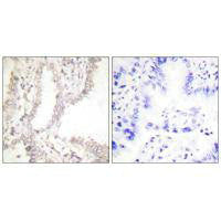 PAWR Antibody