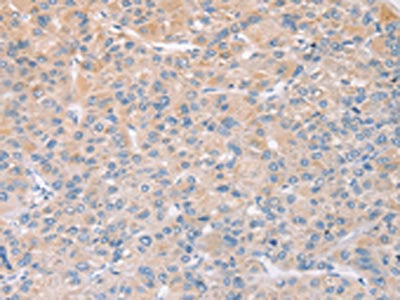 STK16 Antibody