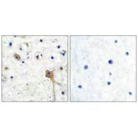 PTPN11 Antibody