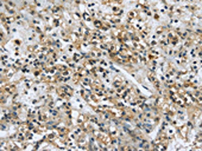 USP28 Antibody