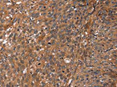 APAF1 Antibody