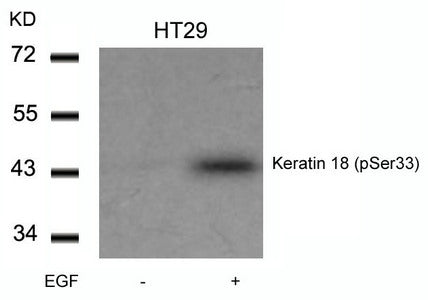 Phospho-KRT18 (Ser33) Antibody