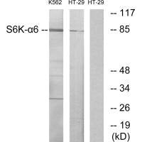 RPS6KA6 Antibody
