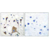 GRIK1 Antibody