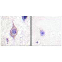 ALK Antibody