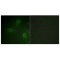 NCF1 (Ab-304) Antibody