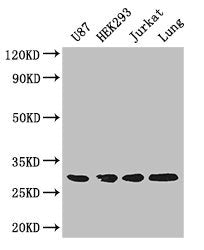LASP1 Antibody