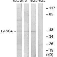 CERS4 Antibody