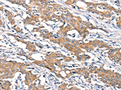 DSC1 Antibody