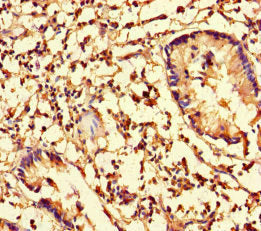 CFL1 Antibody