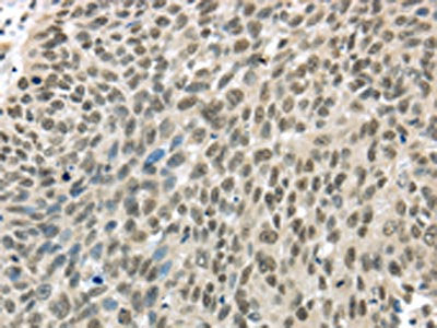 TBL1Y Antibody