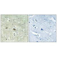 NDUFV3 Antibody