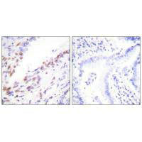 MKI67 Antibody